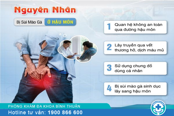 Nguyên nhân gây bệnh sùi mào gà ở hậu môn và cách chữa trị an toàn