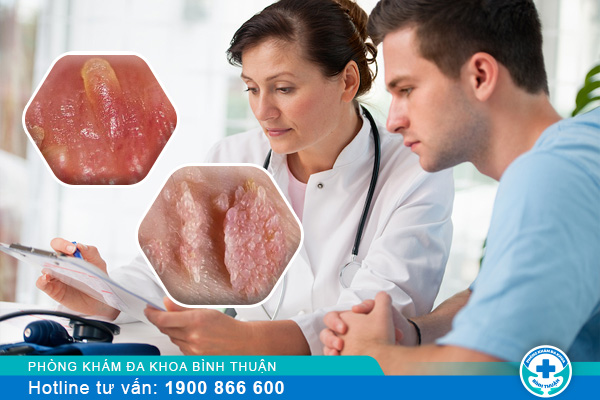 Phân biệt hạt ngọc dương và sùi mào gà như thế nào?