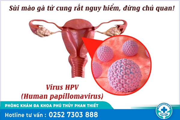 Sùi mào gà ở tử cung - Khó nhận biết và nguy hiểm khôn lường
